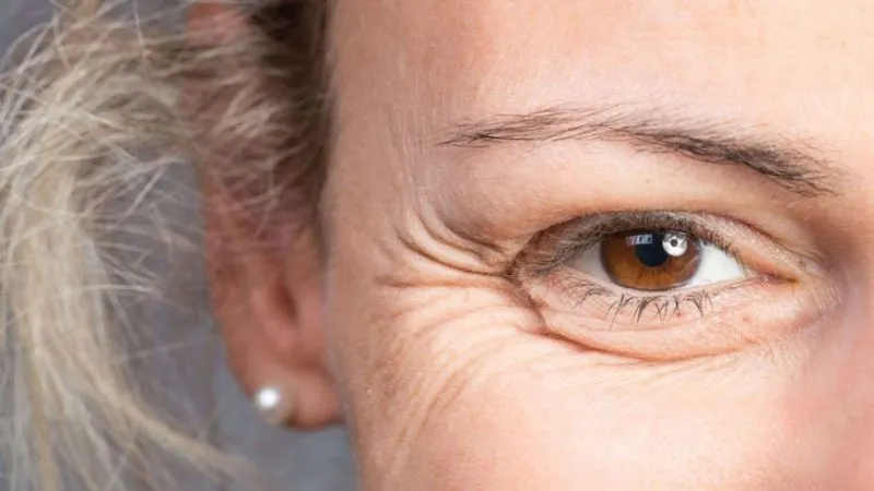 Do tác động thời gian và tuổi tác, mắt của bạn sẽ dần bị sụp và trở nên mất cân đối