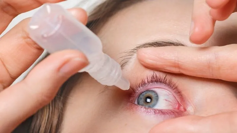 Có thể sử dụng nước mắt nhân tạo để giảm các triệu chứng của dị ứng mắt