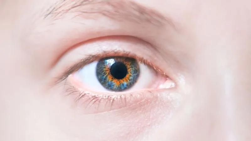 Central Heterochromia 